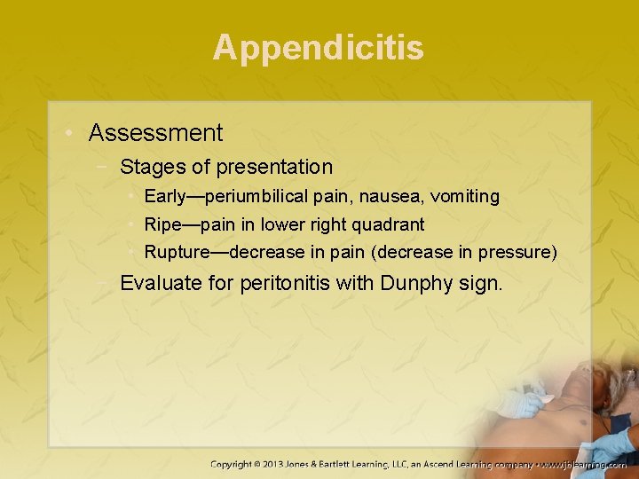 Appendicitis • Assessment − Stages of presentation • Early—periumbilical pain, nausea, vomiting • Ripe—pain
