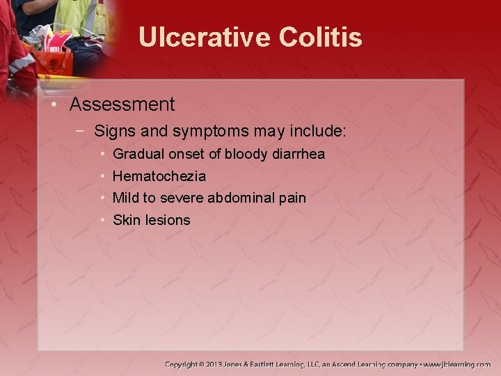 Ulcerative Colitis • Assessment − Signs and symptoms may include: • • Gradual onset