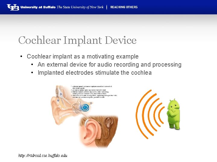 Cochlear Implant Device • Cochlear implant as a motivating example • An external device