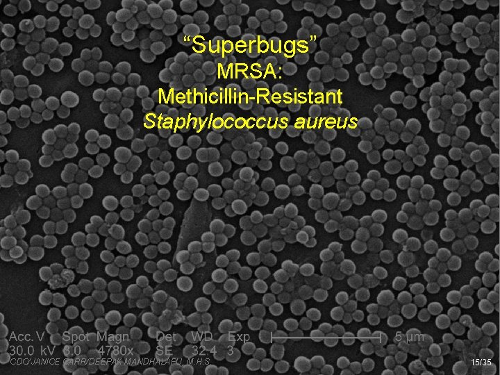 “Superbugs” MRSA: Methicillin-Resistant Staphylococcus aureus CDC/JANICE CARR/DEEPAK MANDHALAPU, M. H. S. 15/35 