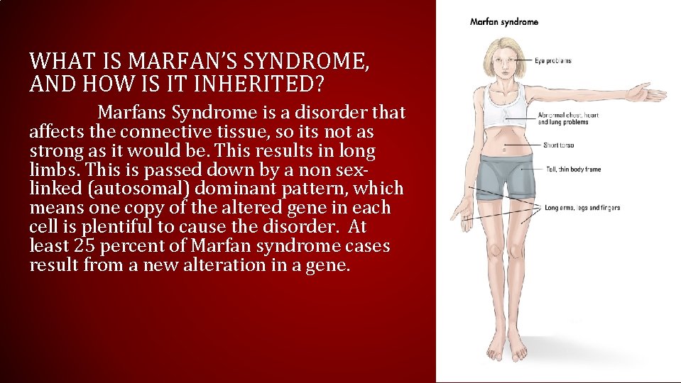 WHAT IS MARFAN’S SYNDROME, AND HOW IS IT INHERITED? Marfans Syndrome is a disorder