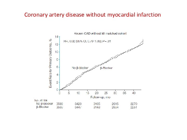 Coronary artery disease without myocardial infarction 