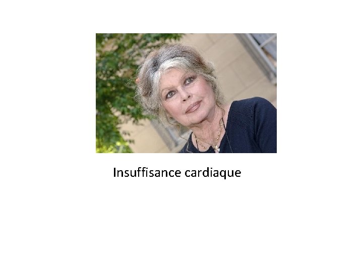 Insuffisance cardiaque 
