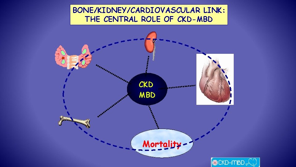 BONE/KIDNEY/CARDIOVASCULAR LINK: THE CENTRAL ROLE OF CKD-MBD CKD MBD Mortality 