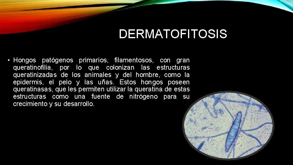 DERMATOFITOSIS • Hongos patógenos primarios, filamentosos, con gran queratinofilia, por lo que colonizan las