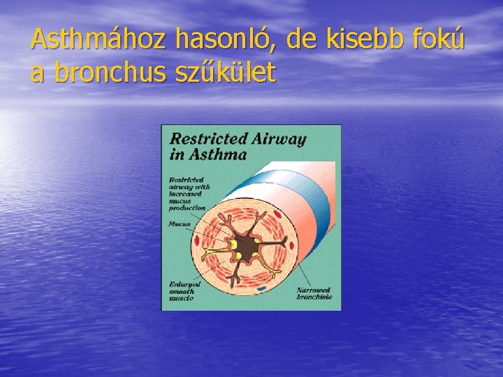 Asthmához hasonló, de kisebb fokú a bronchus szűkület Asthmához hasonló, de kisebb fokú a bronchus szűkület