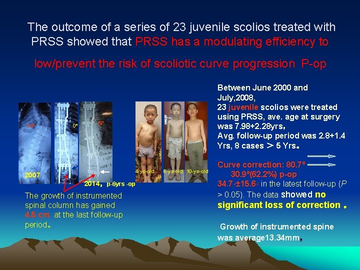The outcome of a series of 23 juvenile scolios treated with PRSS showed that