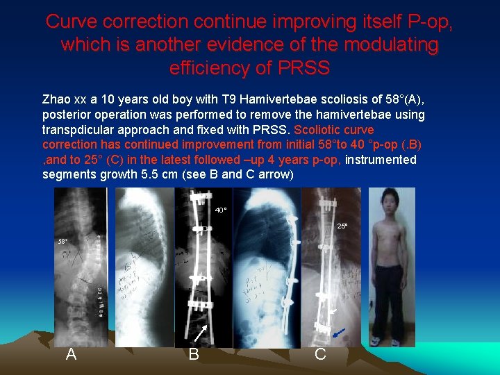 Curve correction continue improving itself P-op, which is another evidence of the modulating efficiency