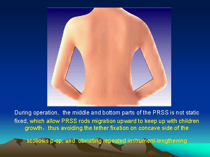 During operation, the middle and bottom parts of the PRSS is not static fixed,