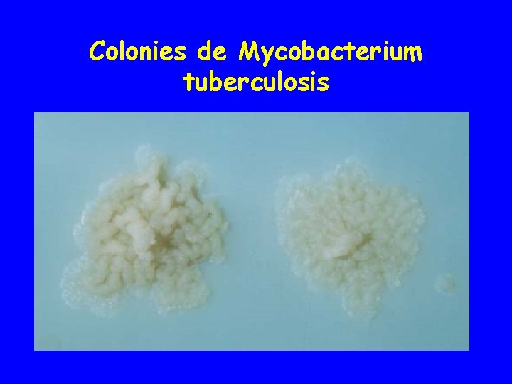 Colonies de Mycobacterium tuberculosis 