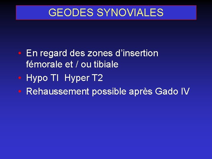 GEODES SYNOVIALES • En regard des zones d’insertion fémorale et / ou tibiale •