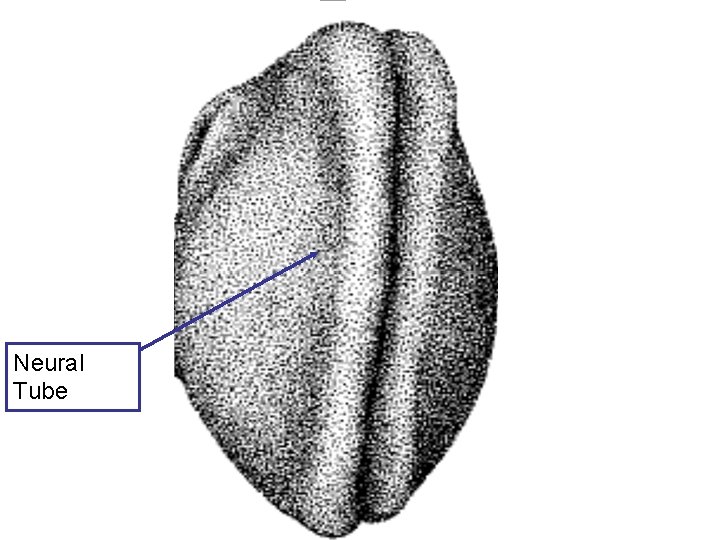 Dorsal view Neural Tube 