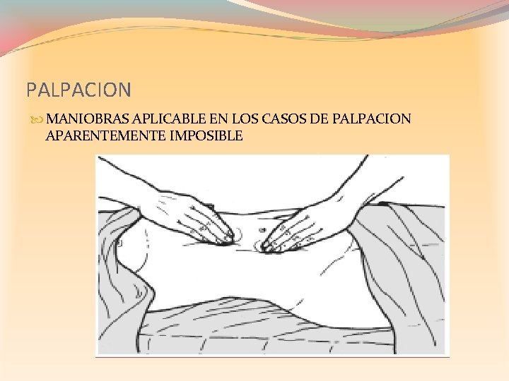 PALPACION MANIOBRAS APLICABLE EN LOS CASOS DE PALPACION APARENTEMENTE IMPOSIBLE 