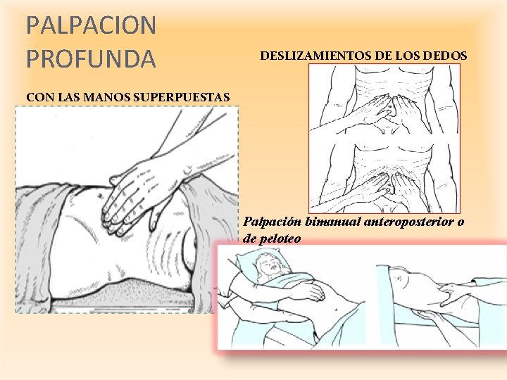 PALPACION PROFUNDA DESLIZAMIENTOS DE LOS DEDOS CON LAS MANOS SUPERPUESTAS Palpación bimanual anteroposterior o