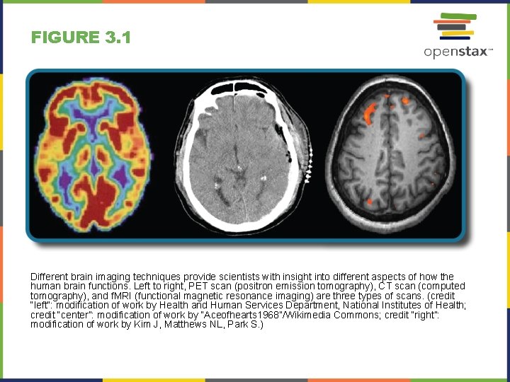 FIGURE 3. 1 Different brain imaging techniques provide scientists with insight into different aspects