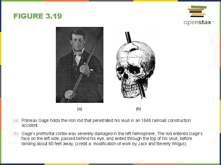 FIGURE 3. 19 (a) Phineas Gage holds the iron rod that penetrated his skull