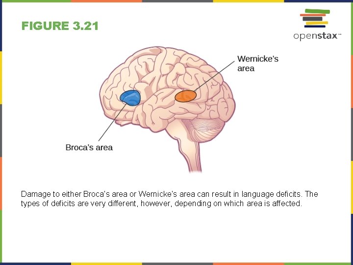 FIGURE 3. 21 Damage to either Broca’s area or Wernicke’s area can result in