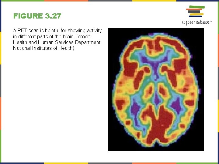 FIGURE 3. 27 A PET scan is helpful for showing activity in different parts
