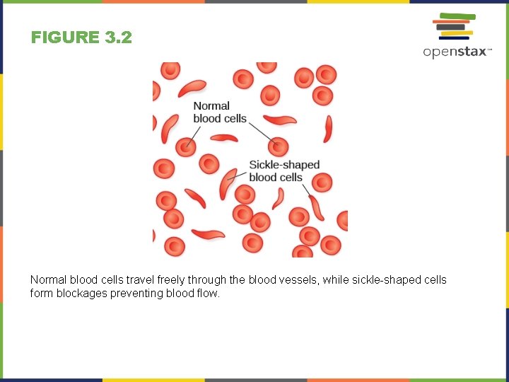 FIGURE 3. 2 Normal blood cells travel freely through the blood vessels, while sickle-shaped