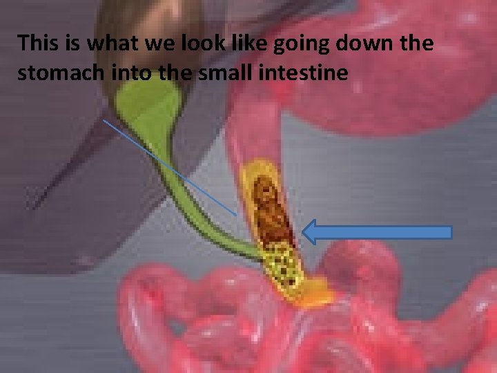 This is what we look like going down the stomach into the small intestine