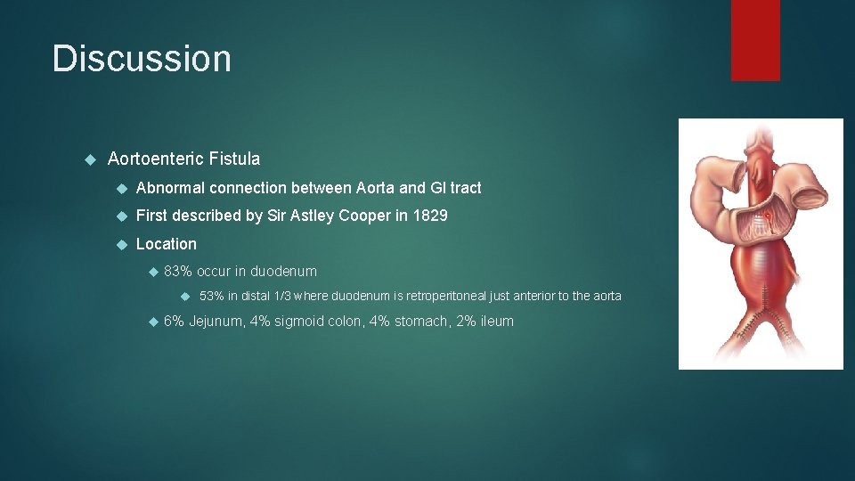 Discussion Aortoenteric Fistula Abnormal connection between Aorta and GI tract First described by Sir