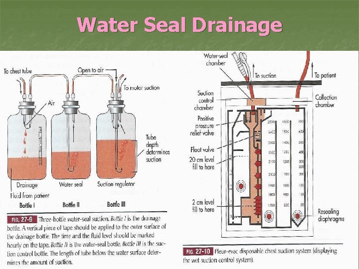Water Seal Drainage 