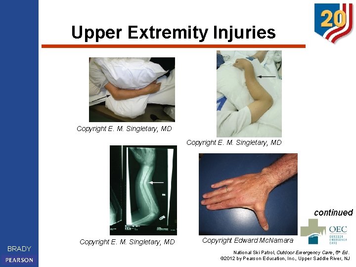 Upper Extremity Injuries Copyright E. M. Singletary, MD continued BRADY Copyright E. M. Singletary,