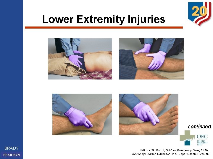 Lower Extremity Injuries continued BRADY National Ski Patrol, Outdoor Emergency Care, 5 th Ed.