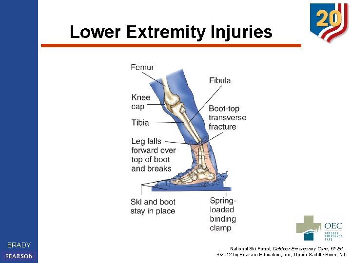 Lower Extremity Injuries BRADY National Ski Patrol, Outdoor Emergency Care, 5 th Ed. ©