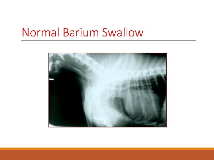 Normal Barium Swallow 