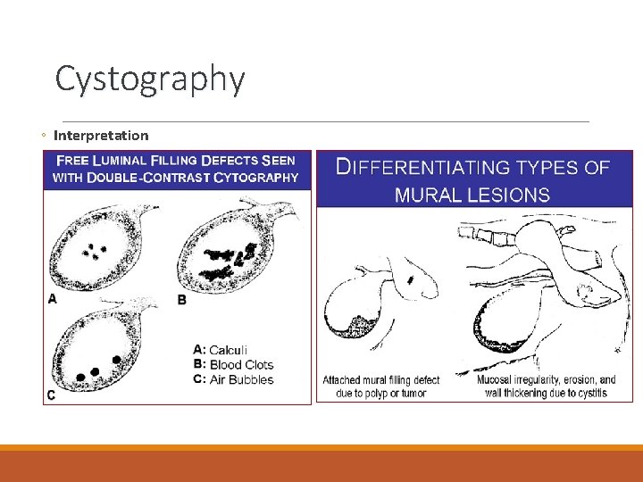 Cystography ◦ Interpretation 
