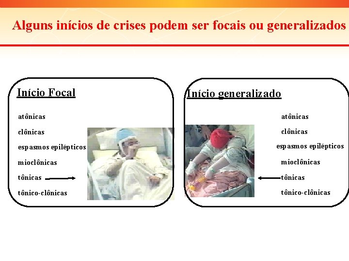 Alguns inícios de crises podem ser focais ou generalizados Início Focal Início generalizado atônicas