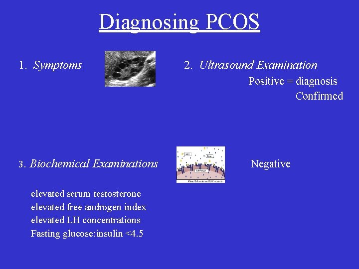 Diagnosing PCOS 1. Symptoms 2. Ultrasound Examination Positive = diagnosis Confirmed 3. Biochemical Examinations
