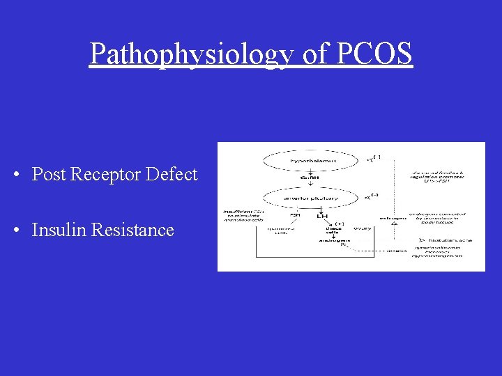 Pathophysiology of PCOS • Post Receptor Defect • Insulin Resistance 