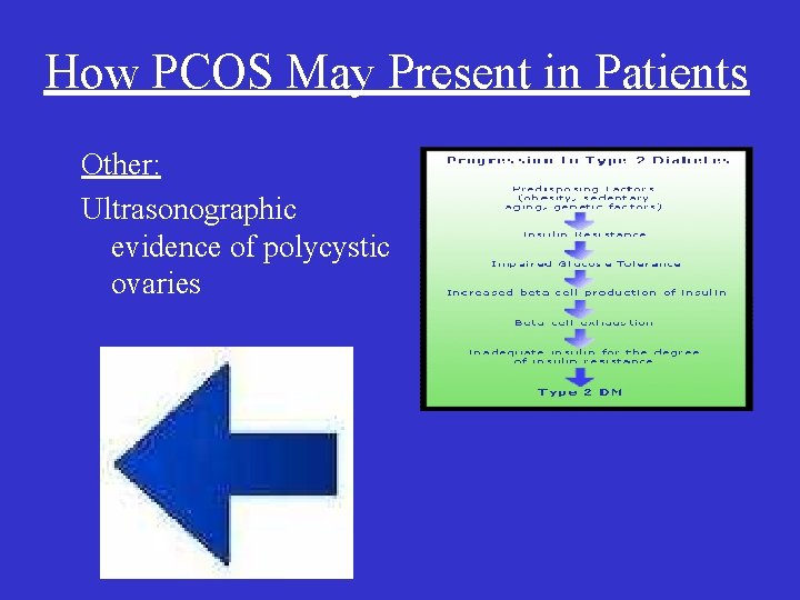 How PCOS May Present in Patients Other: Ultrasonographic evidence of polycystic ovaries 