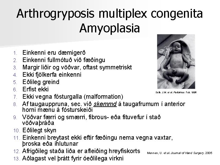 Arthrogryposis multiplex congenita Amyoplasia 1. 2. 3. 4. 5. 6. 7. 8. 9. 10.