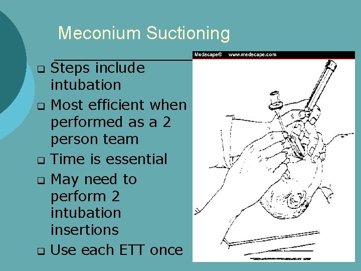 Meconium Suctioning q q q Steps include intubation Most efficient when performed as a