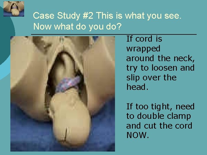Case Study #2 This is what you see. Now what do you do? If