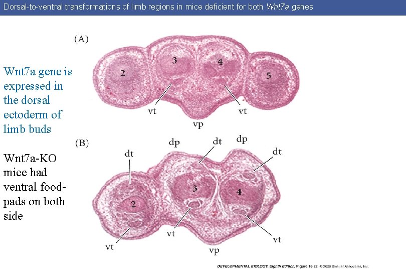 Dorsal-to-ventral transformations of limb regions in mice deficient for both Wnt 7 a genes