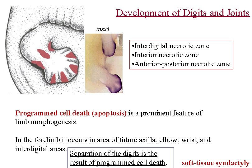 Development of Digits and Joints • Interdigital necrotic zone • Interior necrotic zone •
