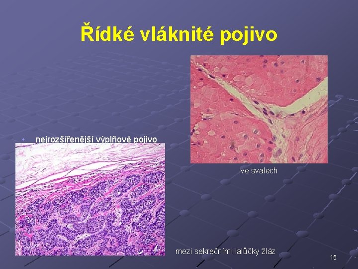 Řídké vláknité pojivo • • nejrozšířenější výplňové pojivo proniká do všech tkání • •