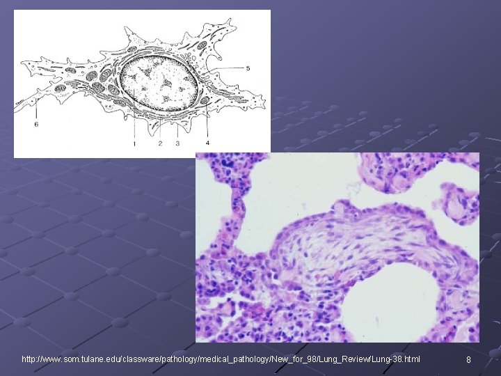 http: //www. som. tulane. edu/classware/pathology/medical_pathology/New_for_98/Lung_Review/Lung-38. html 8 