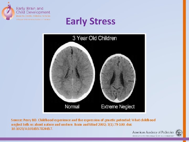 Early Stress Source: Perry BD. Childhood experience and the expression of genetic potential: What