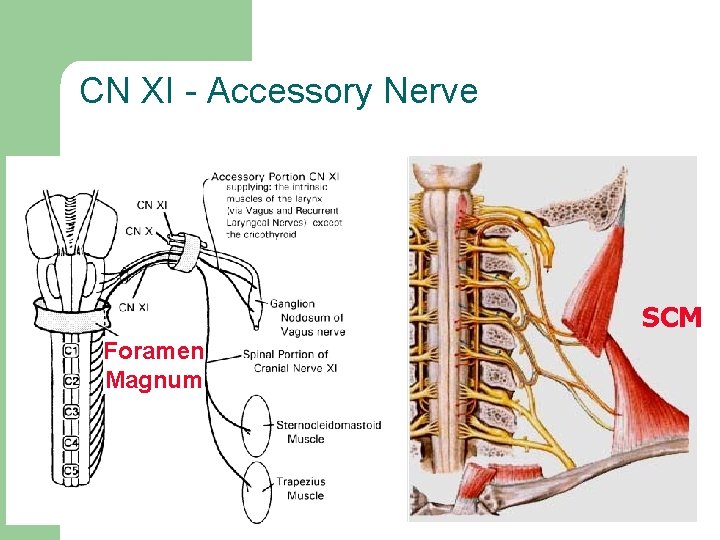 CN XI - Accessory Nerve SCM Foramen Magnum 