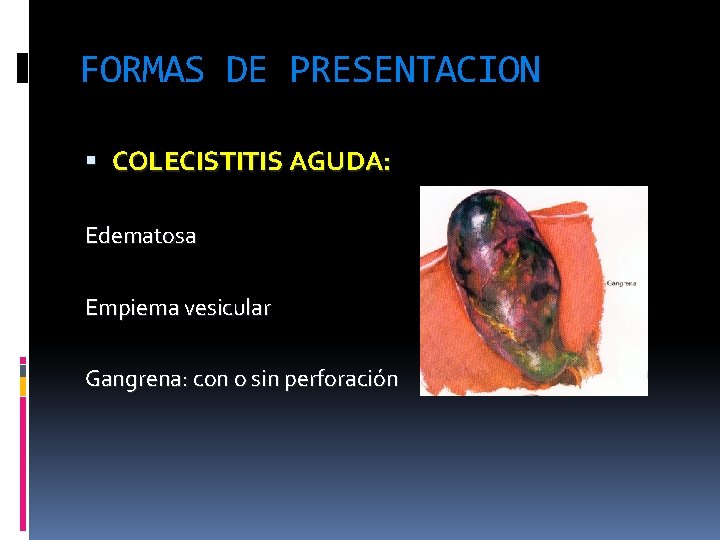 FORMAS DE PRESENTACION COLECISTITIS AGUDA: Edematosa Empiema vesicular Gangrena: con o sin perforación 