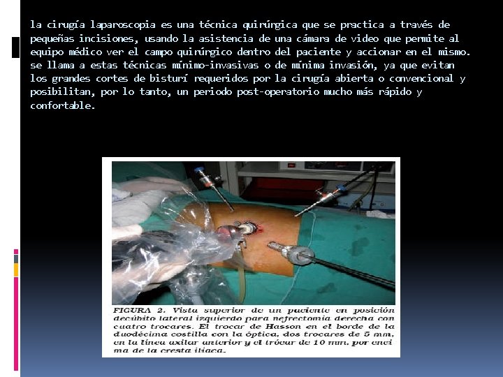 la cirugía laparoscopia es una técnica quirúrgica que se practica a través de pequeñas