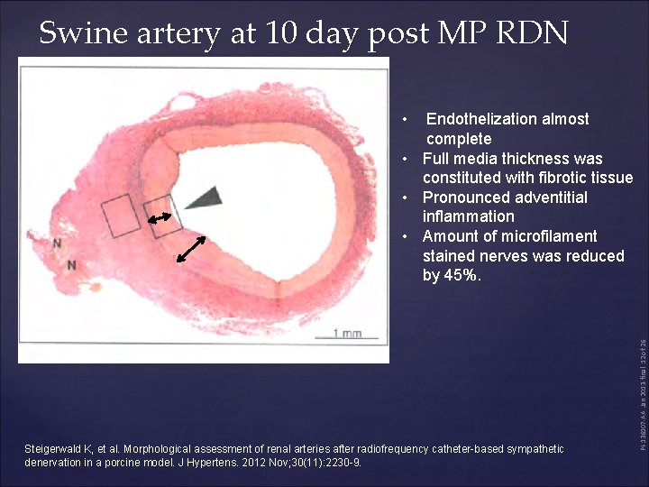 Swine artery at 10 day post MP RDN • Steigerwald K, et al. Morphological