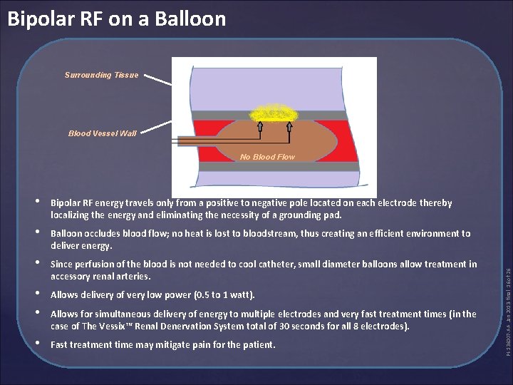 Bipolar RF on a Balloon Surrounding Tissue Blood Vessel Wall • Bipolar RF energy