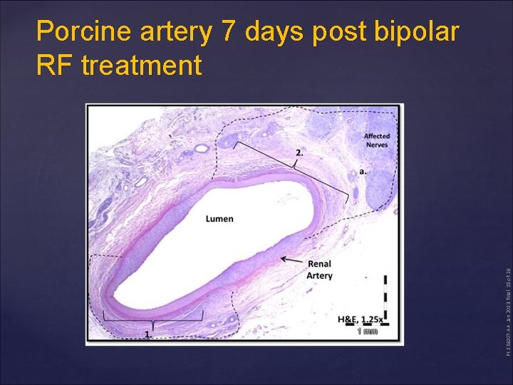 PI-136107 -AA Jan 2013 -final 18 of 26 Porcine artery 7 days post bipolar