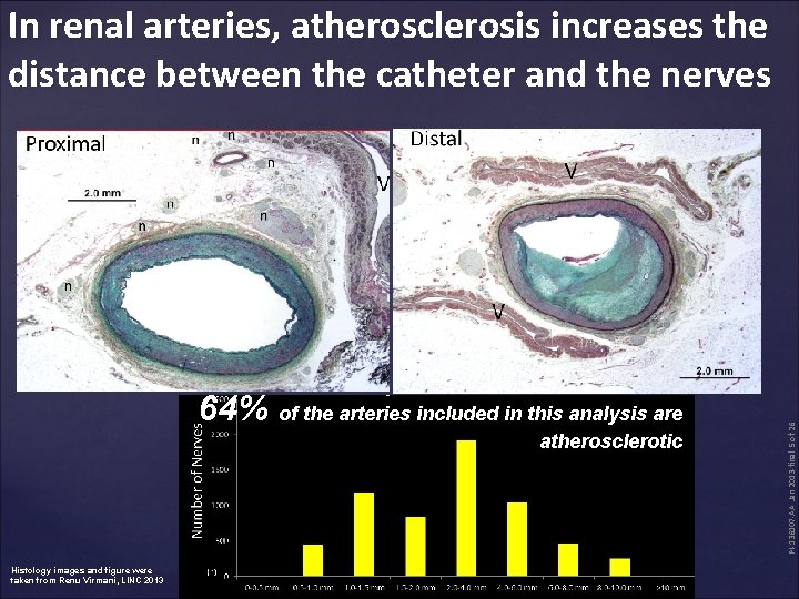 64% of the arteries included in this analysis are atherosclerotic Histology images and figure
